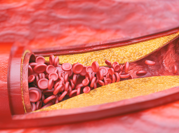 Cholesterol: zabójca czy sprzymierzeniec?