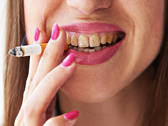 Jak palenie papierosów wpływa na nasze zęby?