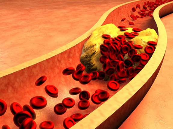 Cholesterol powoduje raka?